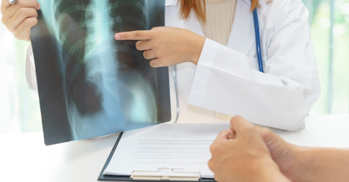 How to Read an Asthma Spirometry Test for Lung Function